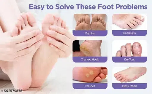 GharNeeds™ Goat Milk Exfoliating & Peeling Foot Mask
