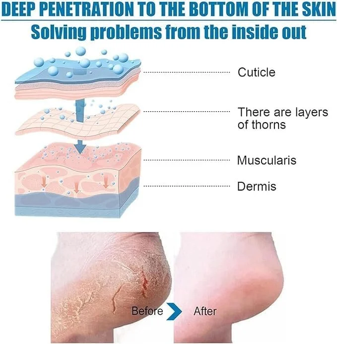 GharNeeds™ Goat Milk Exfoliating & Peeling Foot Mask